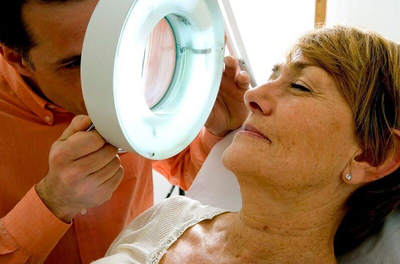 Procedemento para examinar o papiloma na cara